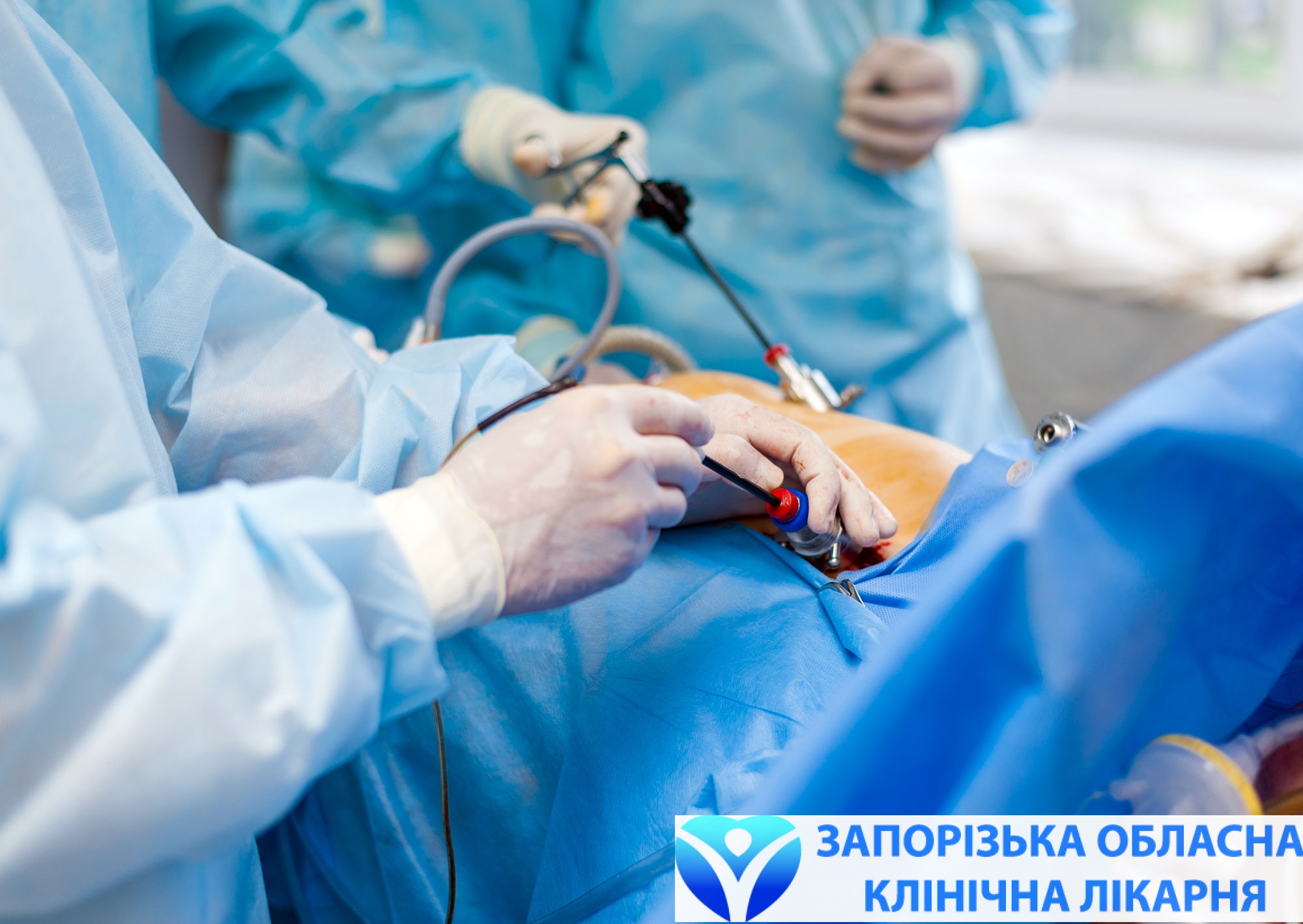 laparoskopiya-v-zaporozhskoy-oblboln