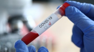 Кількість хворих на коронавірус у Запорізькій області зростає швидкими темпами