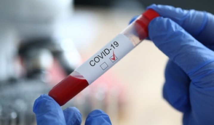 Кількість хворих на коронавірус у Запорізькій області зростає швидкими темпами