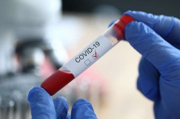 Кількість хворих на коронавірус у Запорізькій області зростає швидкими темпами