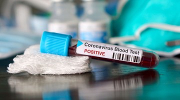 У Запорізькій області зафіксували нові смерті від ускладнень коронавірусу