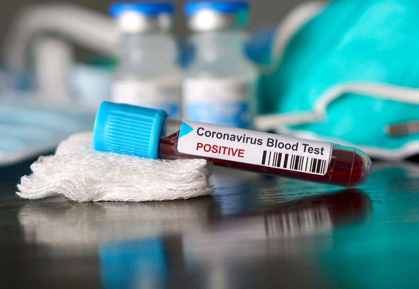 У Запорізькій області зафіксували нові смерті від ускладнень коронавірусу